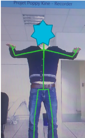 tag:kinect-1.png